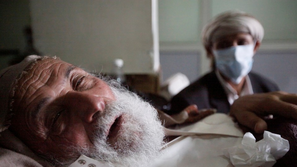 An old man infected with cholera lies on the bed at a hospital in Sanaa, Yemen on May 12, 2017. 
