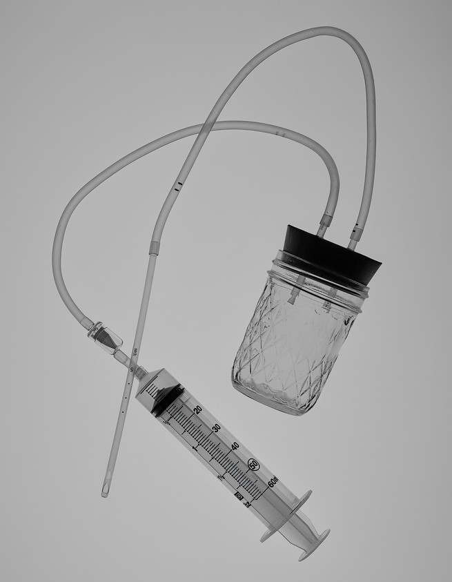 black and white photo of a Del-Em device: sealed mason jar with two flexible tubes into stopper, one connected to syringe, one connected to cannula 
