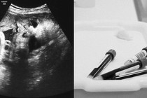 A pregnancy scan next to a photo of vials of blood