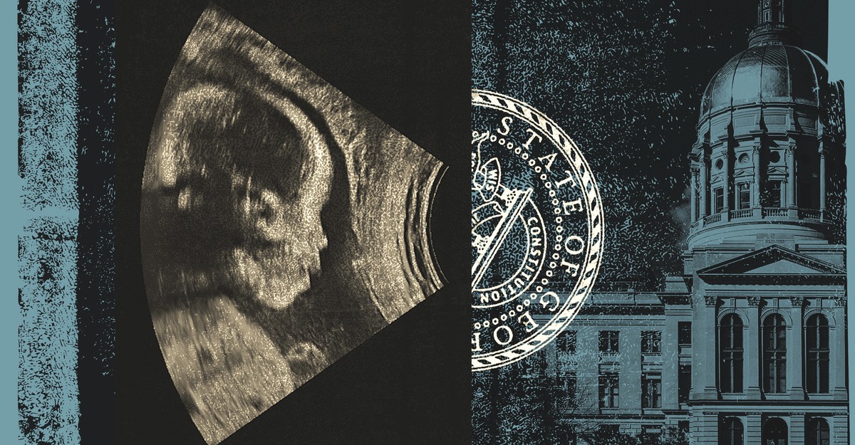 cdn.theatlantic.com image