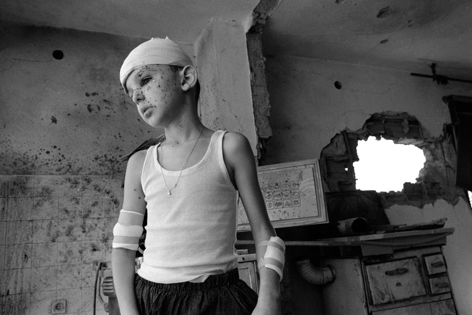 Picture of a little boy, wounded when a shell was lobbed by Bosnian Croat forces into the Muslim quarter of Mostar, stands in his destroyed home. 