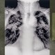 An X-ray image from the 20th century