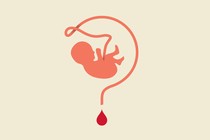 Illustration of an umbilical cord as a question mark