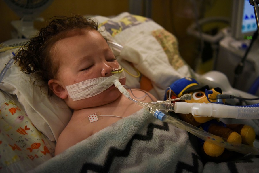 A young child is seen in a hospital bed on a ventilator.