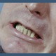 An image of a man clenching his teeth