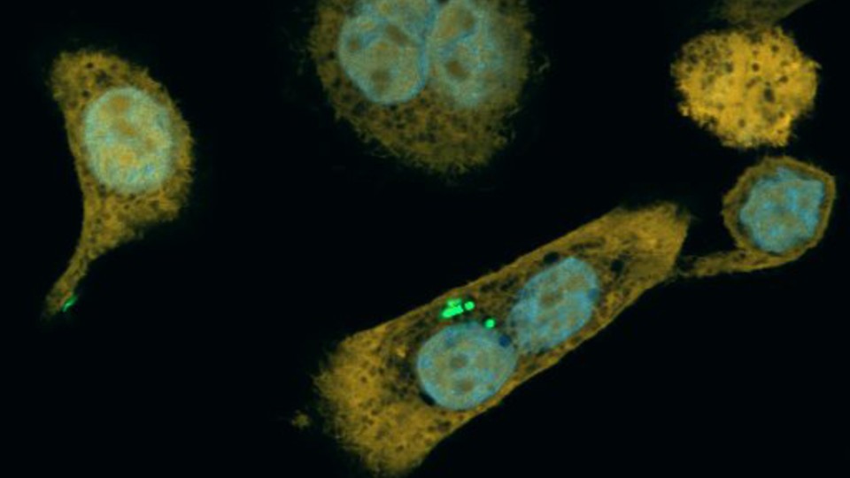 Microscope image of bacteria inside a pancreatic cancer cell