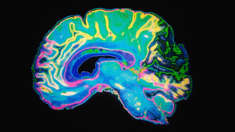 An artificially colored MRI scan of the human brain