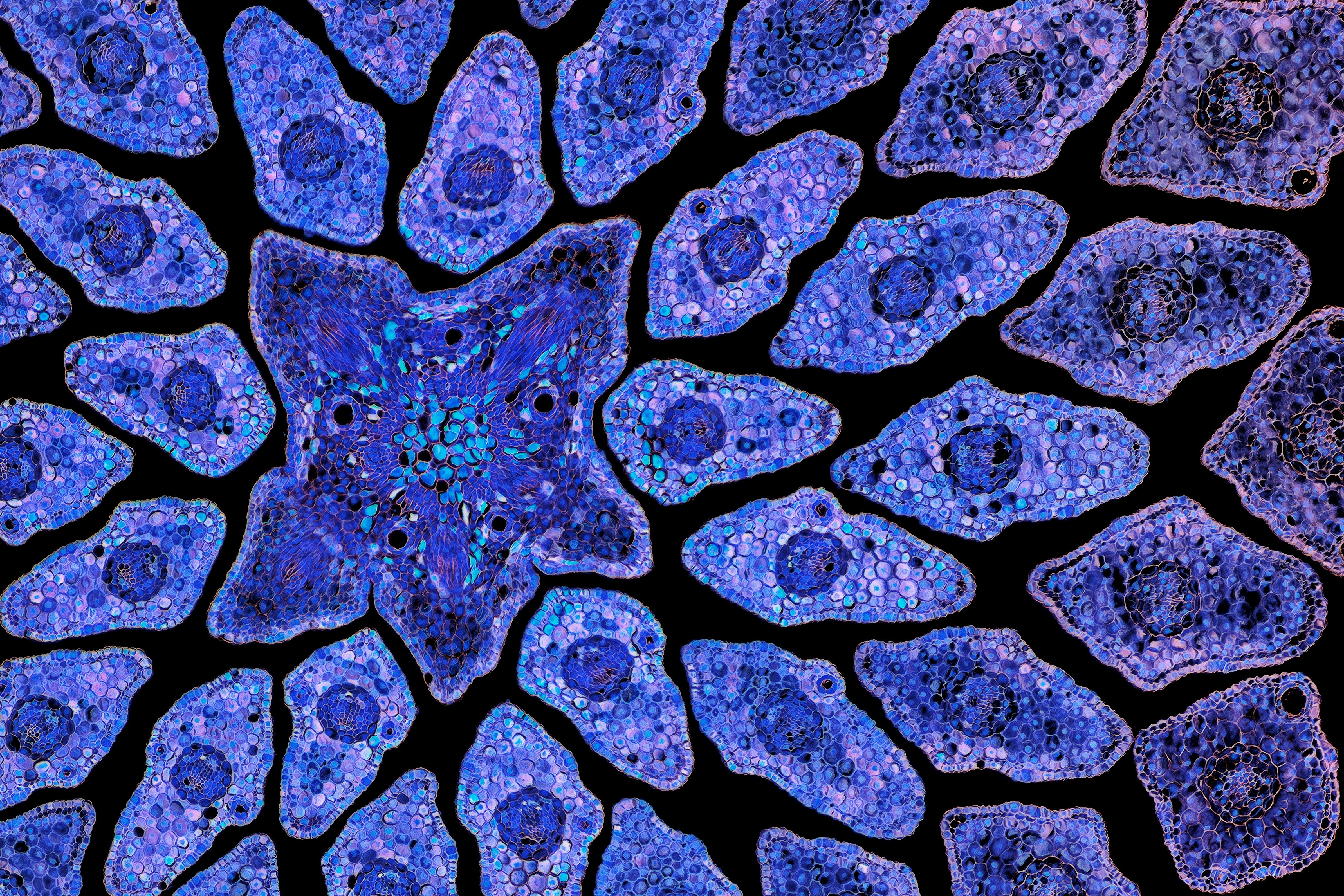 Purple-colored blobs, visible in a microscopic cross-section of a spruce tree