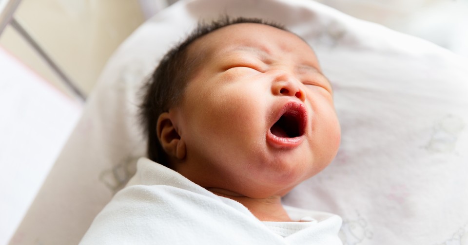 Why So Many Babies Are Getting Their Tongues Clipped