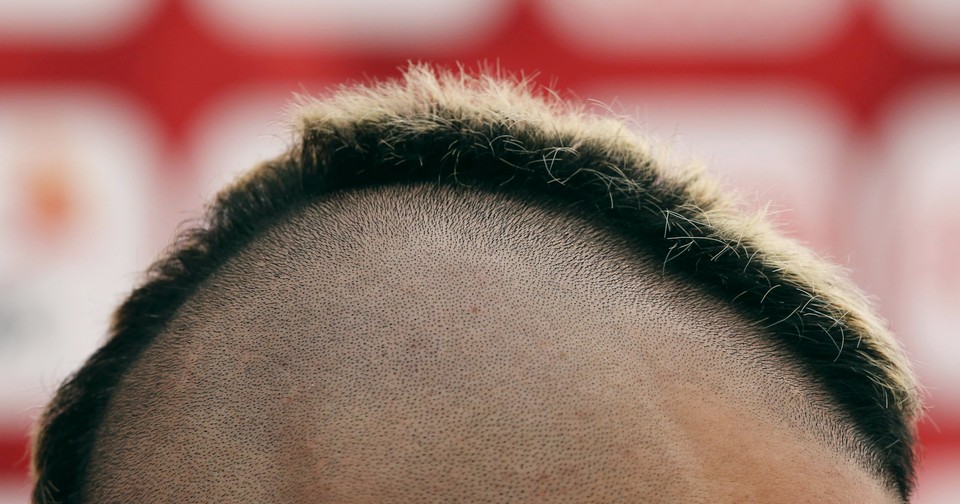 A A