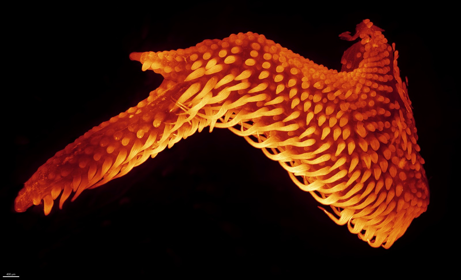 A microscopic view of the wing of a chicken embryo