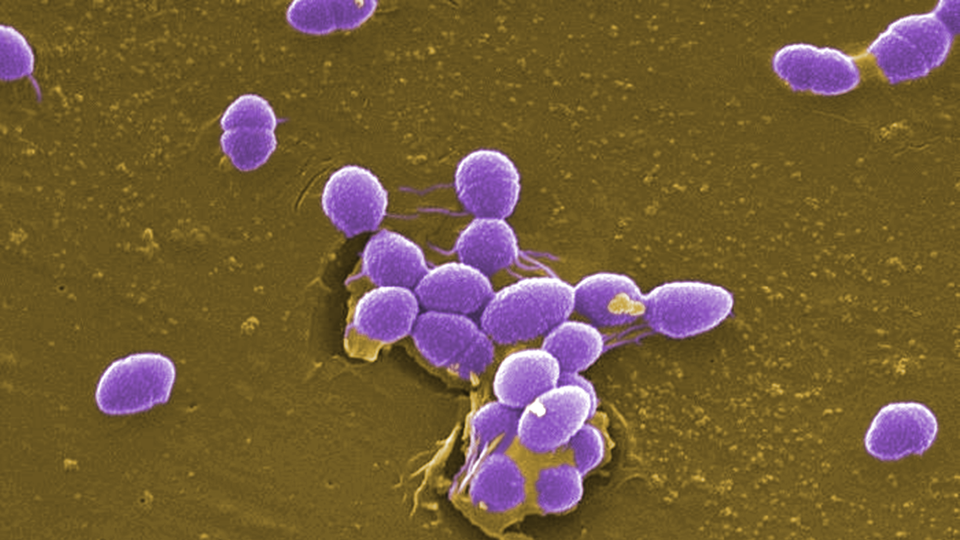 False color micrograph of Enterococcus faecalis