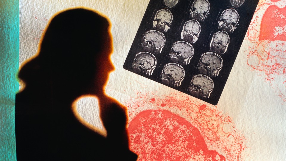 Silhouette of a doctor looking at an MRI scan