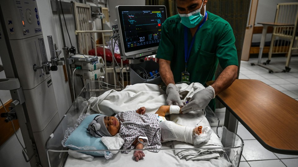 Amina Sharifi, an Afghan newborn, receives treatment for a gunshot wound in her leg.