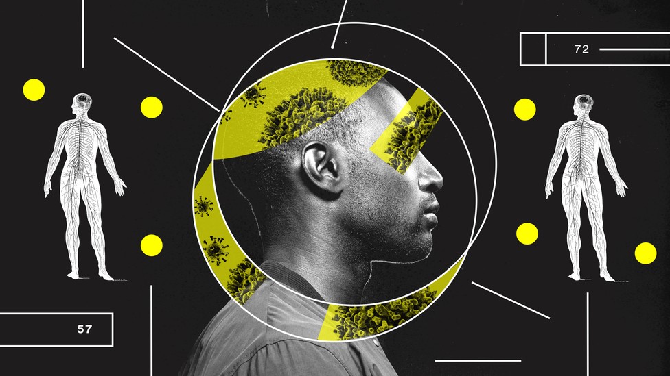 A man's face in profile, surrounded by two circles with cutouts of coronavirus, flanked by two anatomy drawings show the circulatory system