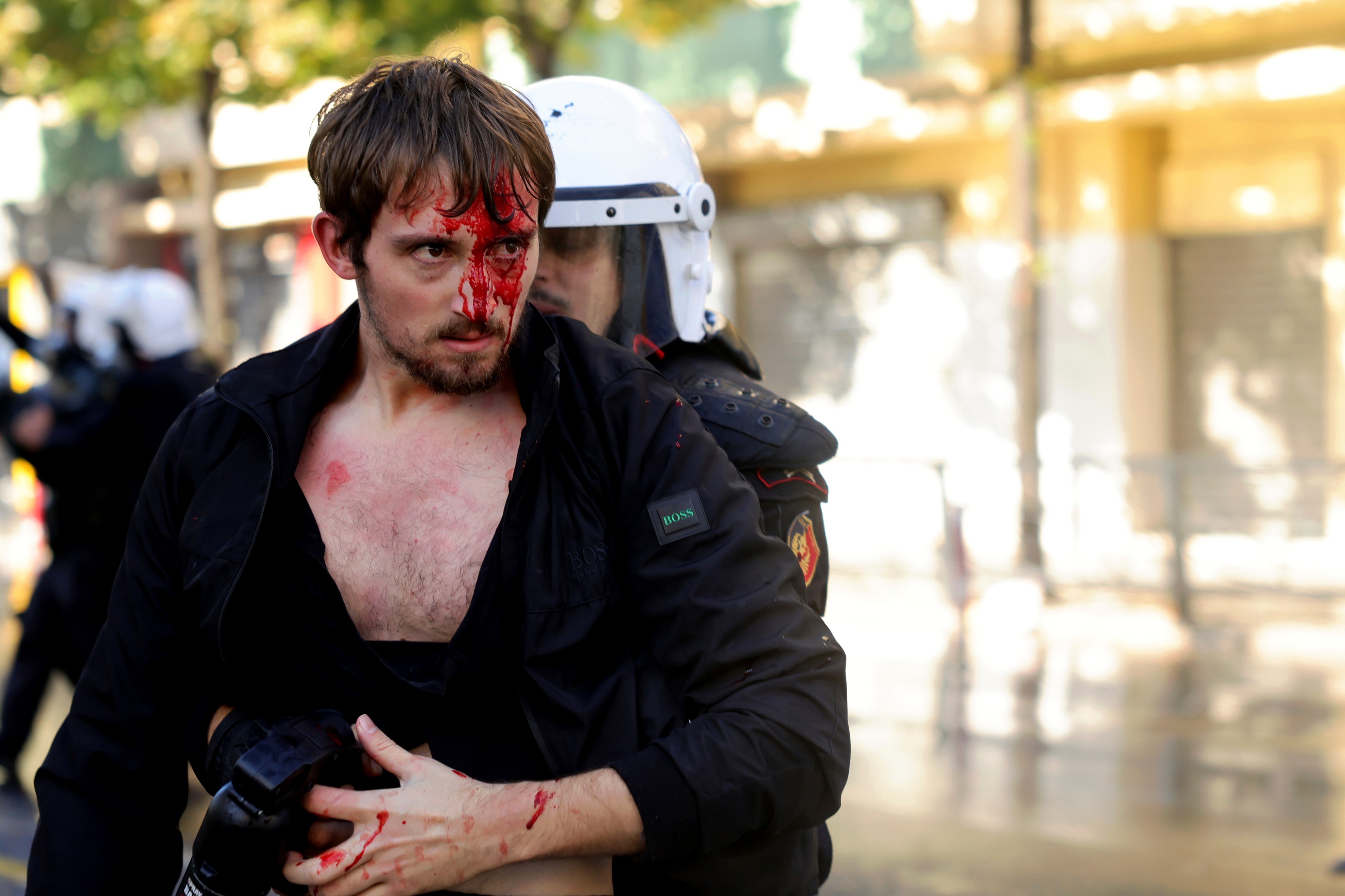A riot police officer detains an injured protester with a bloodied face.