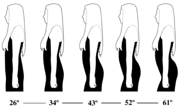 Why do human females tend to have bigger buttocks than males? - Quora