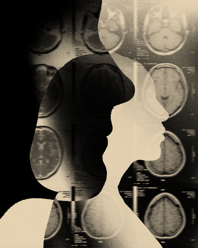 An illustration of a silhouette of a woman's face