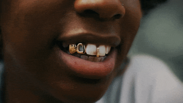 A GIF of a woman smiling with gold teeth