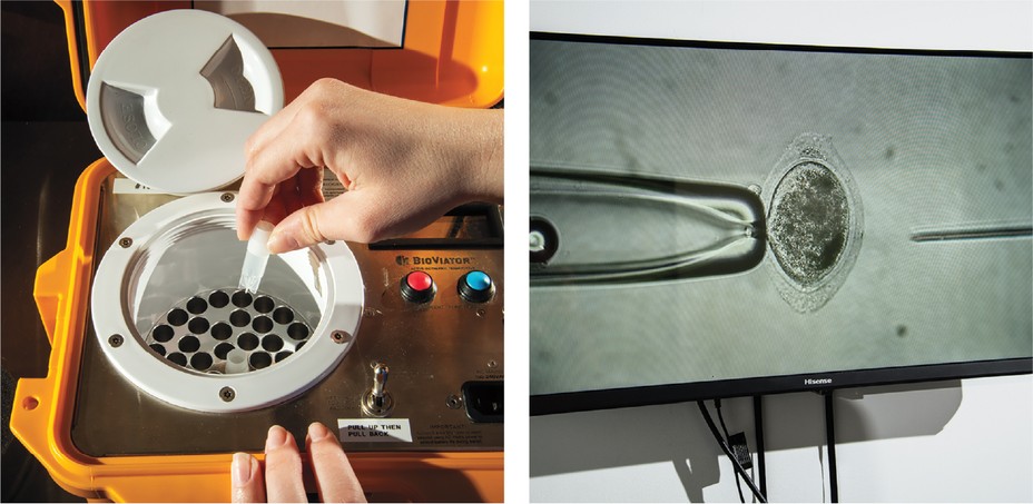 hand putting sample into round lidded BioViator machine; computer monitor showing enlarged microscopic cell at end of pipette with needle