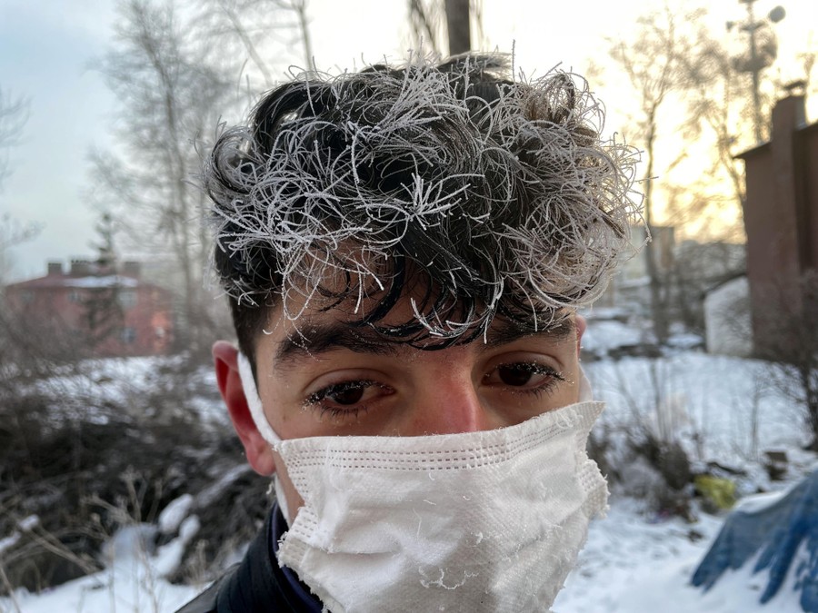 A boy is seen outside with frost covering the tips of his hair.