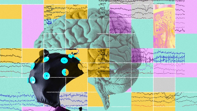 How To Read A Qeeg Brain Map