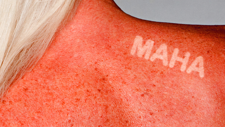 Photo-illustration of a sunburned back and shoulder, with the letters "MAHA" unburned