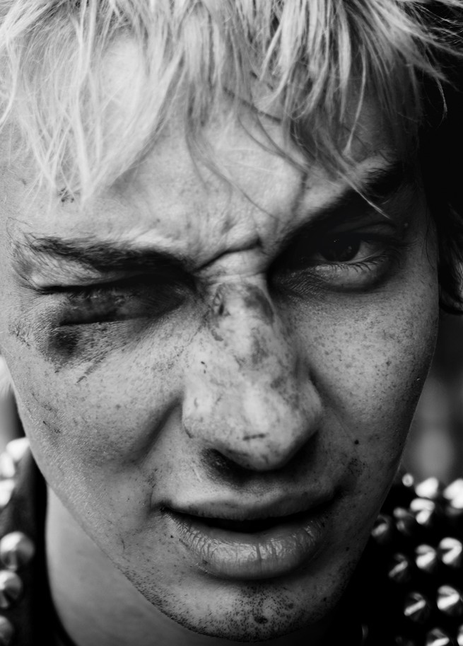 photo of boy with beat-up face