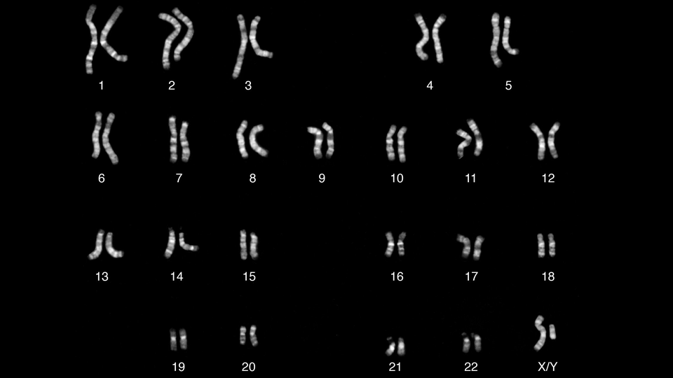 Chromosomes of a male individual, with Y in the lower right corner