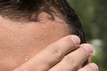 Close-up photograph of someone wiping their sweaty brow