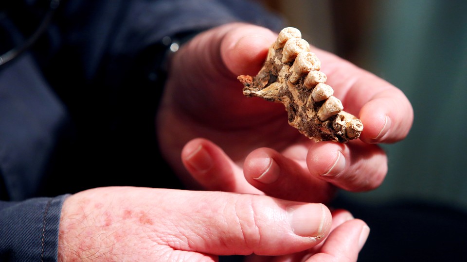 A person holds a fragment of a human jawbone and teeth.