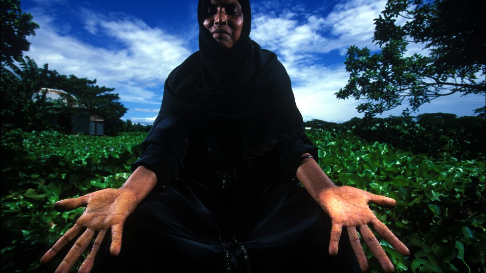 A woman displays her hands in front of a planted field.