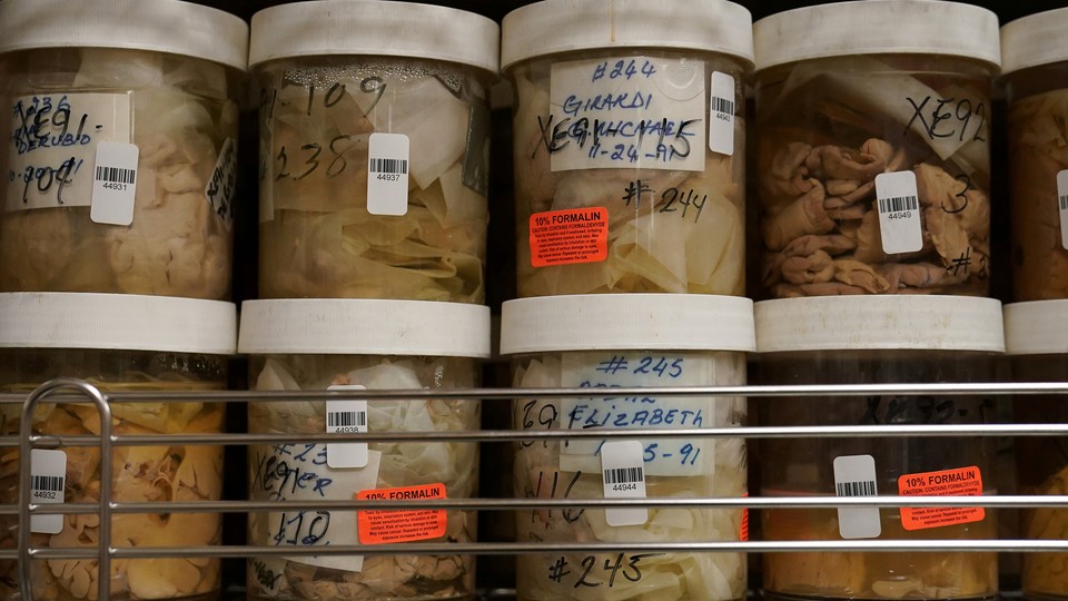 Human brains stored in jars filled with formaldehyde on shelves