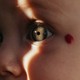 A photo of a baby with fair skin, green eyes, and a red mark next to their left eye. A line of sunlight cuts vertically through their face and left eye.