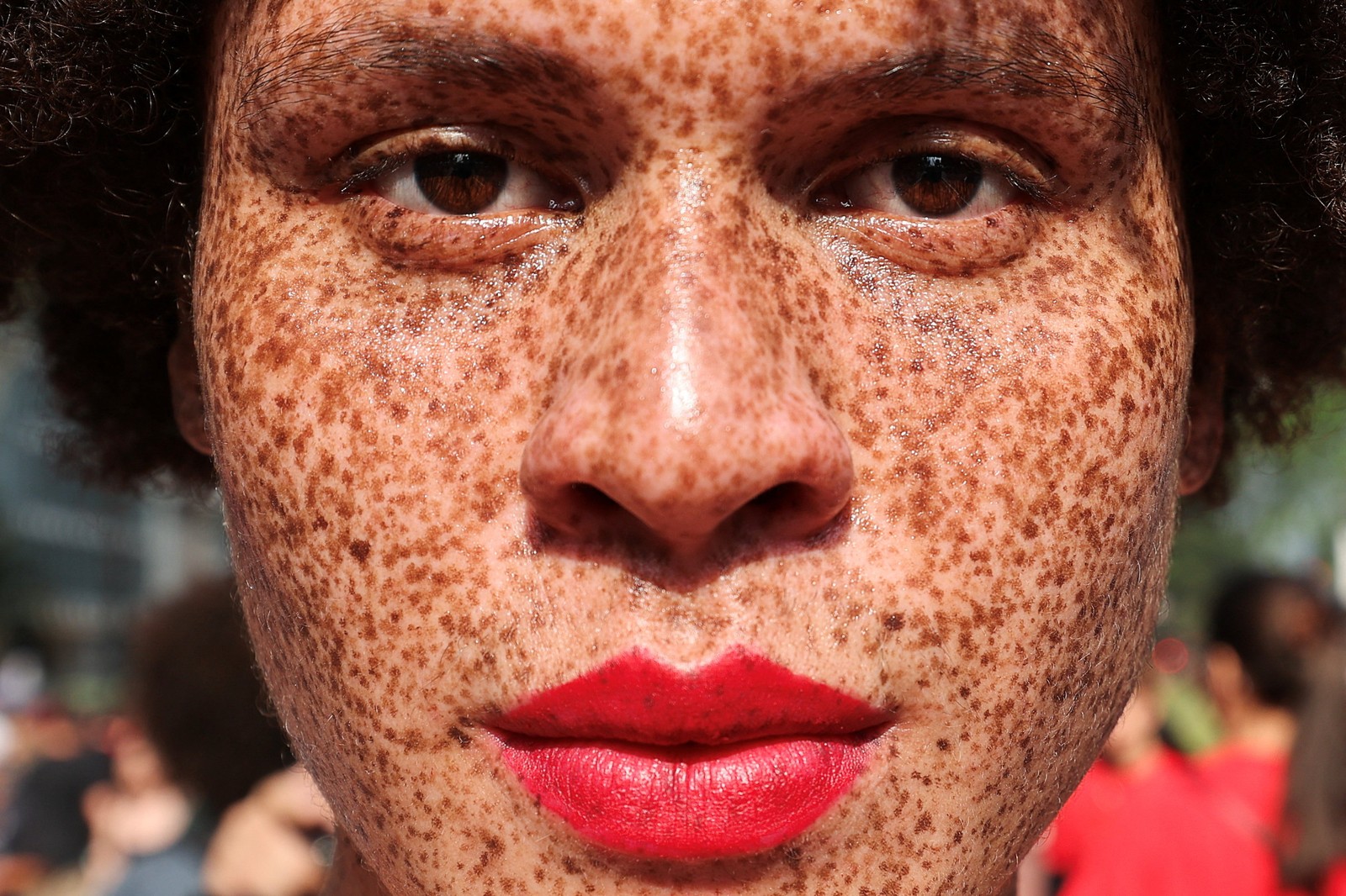 A close portrait of a person's face with many freckles.