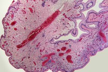 A cellular view of the uterine lining during a pregnancy, which forms the maternal side of the placenta. This image shows the columnar epithelial cells, the stromal cells, and the abundant vascularization of this tissue.