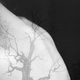 overlayed images of a woman's neck and back and trees, one in the center with gnarled branches