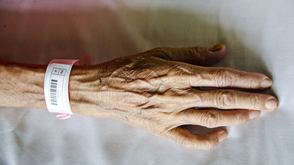 The hand of an elderly patient