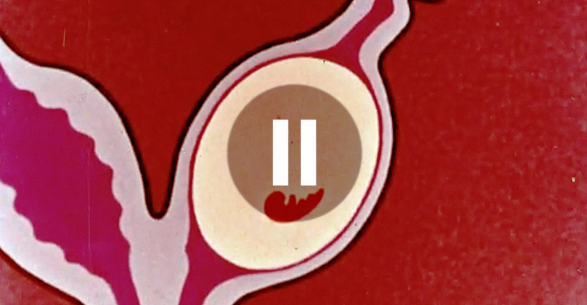 NextImg:Pregnancy Shouldn’t Work Like This