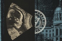 Collage of an ultrasound, the Georgia state capitol, and the Georgia state seal
