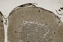 An image of the cerebellum