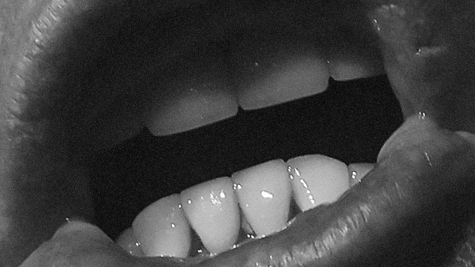 A close-up of teeth