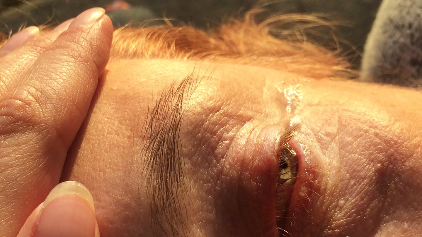 The sun shining on someone's eye, with a hand on their forehead