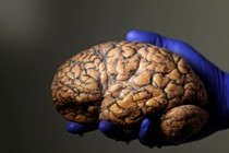 A gloved hand holds a human brain 