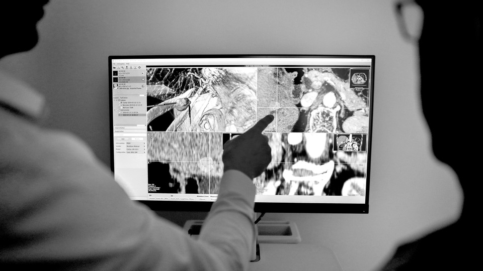 A doctor points at an X-ray image.