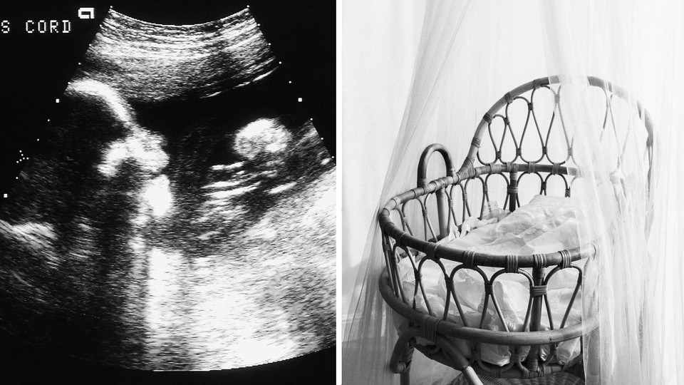 An ultrasound image and a photo of an empty cradle