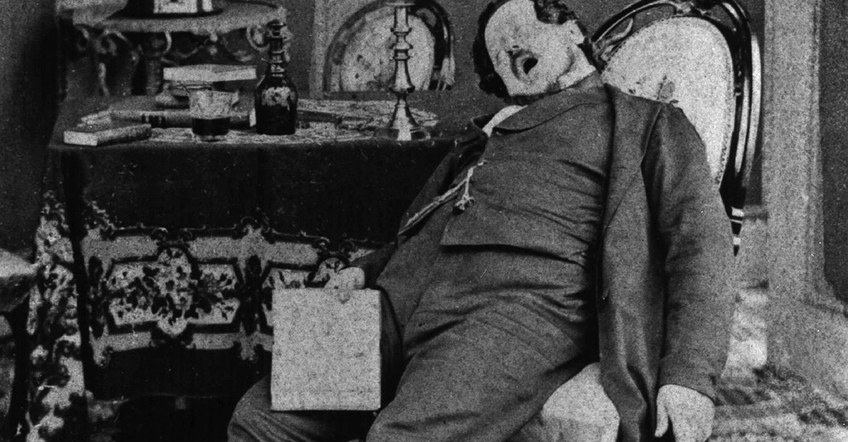 You Don't Have to Snore