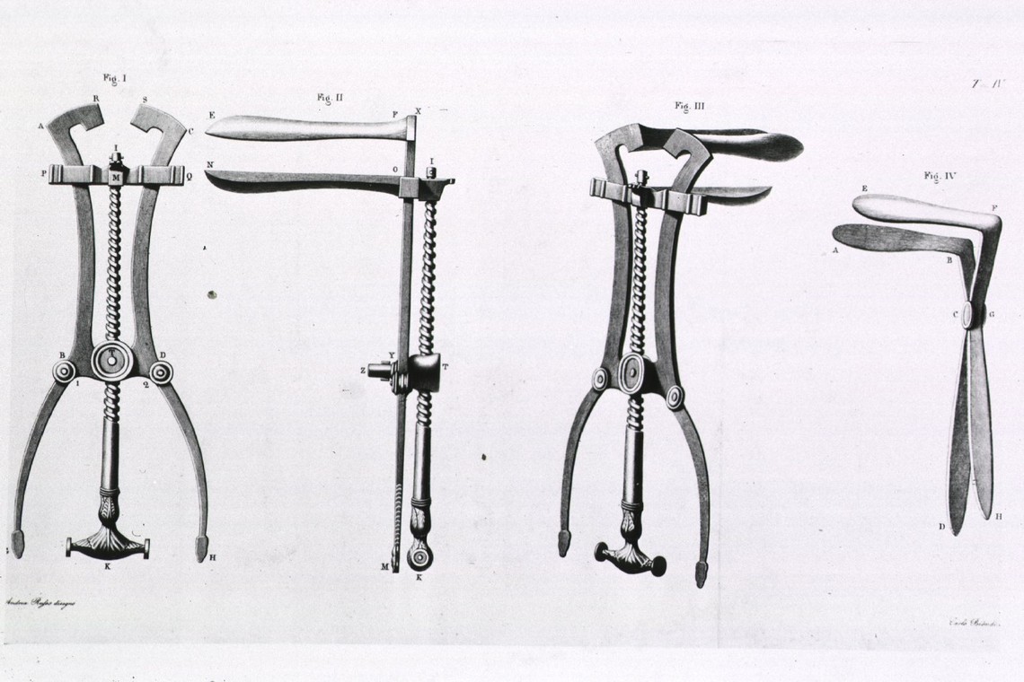 Why No One Can Design a Better Speculum The Atlantic