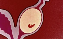 an animation of an embryo developing in a uterus but then being paused