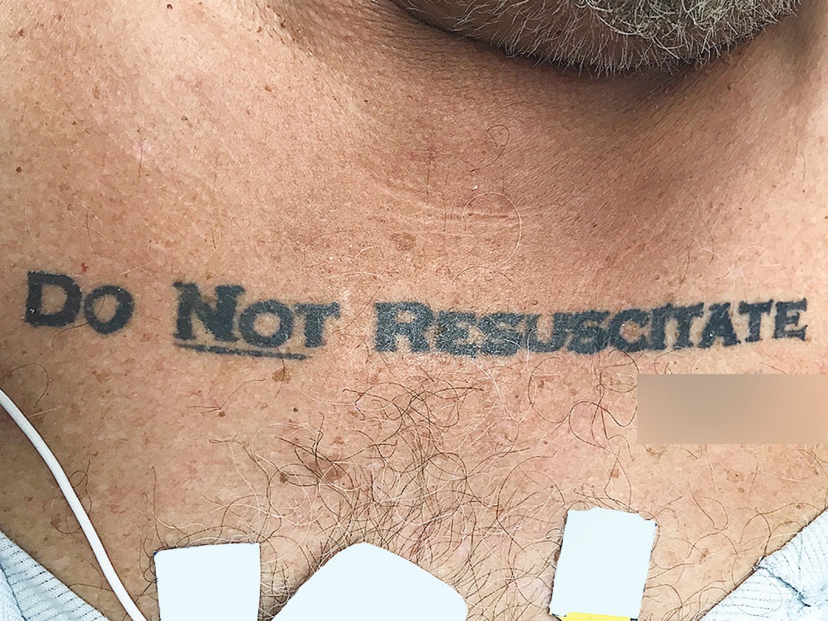 What to Do When a Patient Has a 'Do Not Resuscitate' Tattoo - The Atlantic